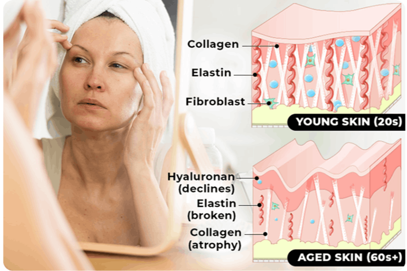 Aiven ContourLift Sculptor